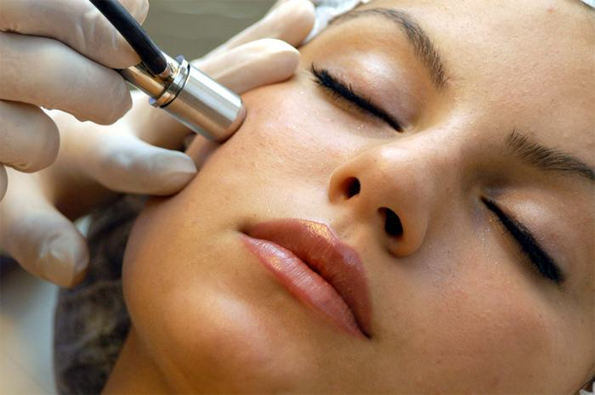 Complete Guide to Microdermabrasion at Home